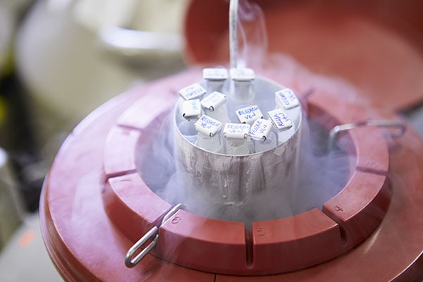 Banco de semen: Preservando tu futuro