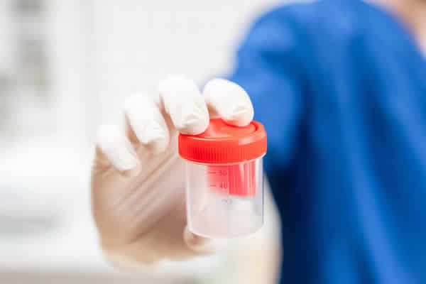 La importancia del Test del Túnel en la fertilidad masculina
